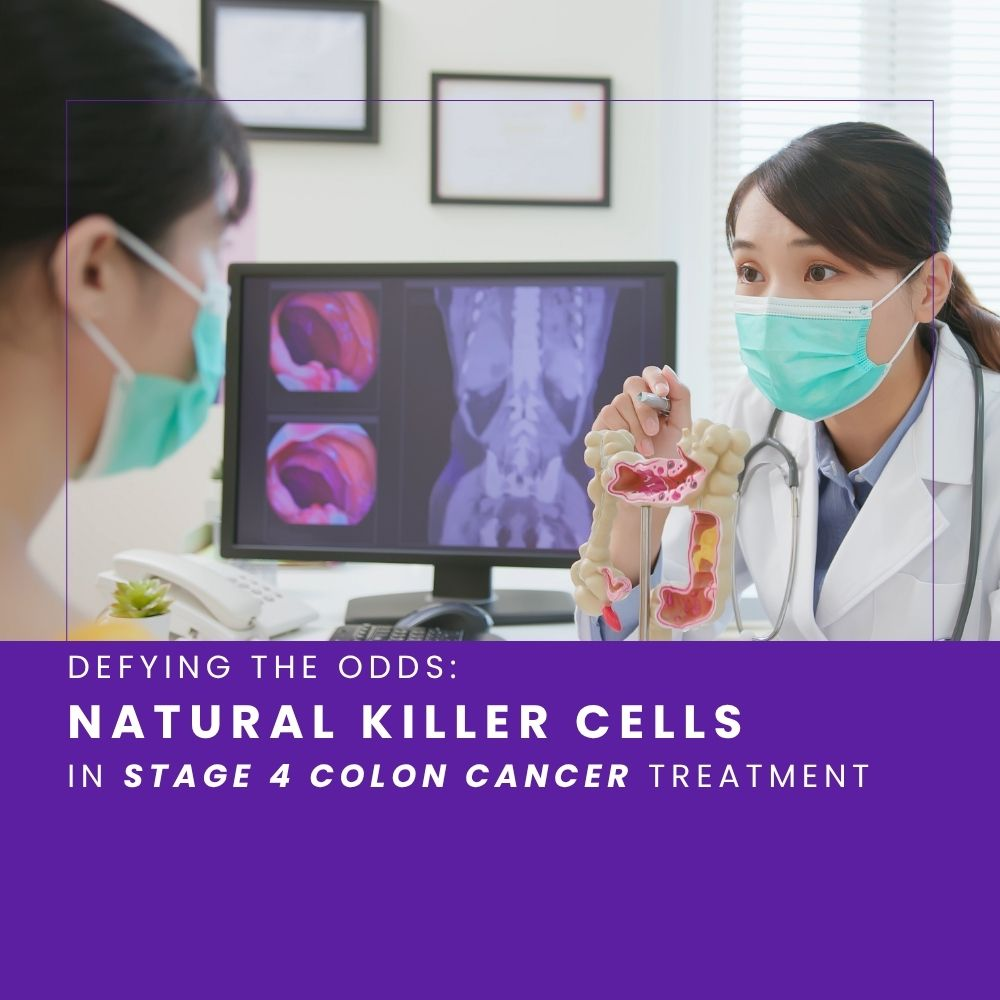 Defying the Odds: Natural Killer Cells in Stage 4 Colon Cancer Treatment