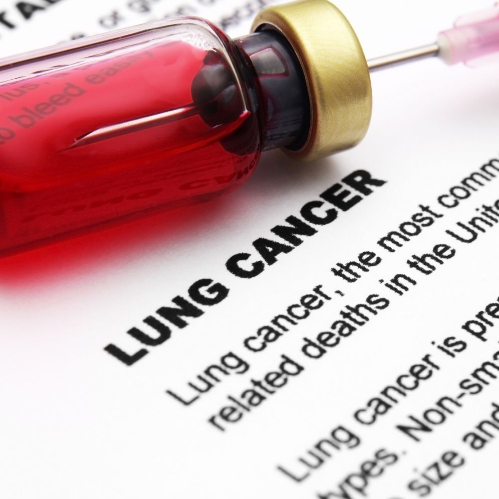 stage 4 lung cancer