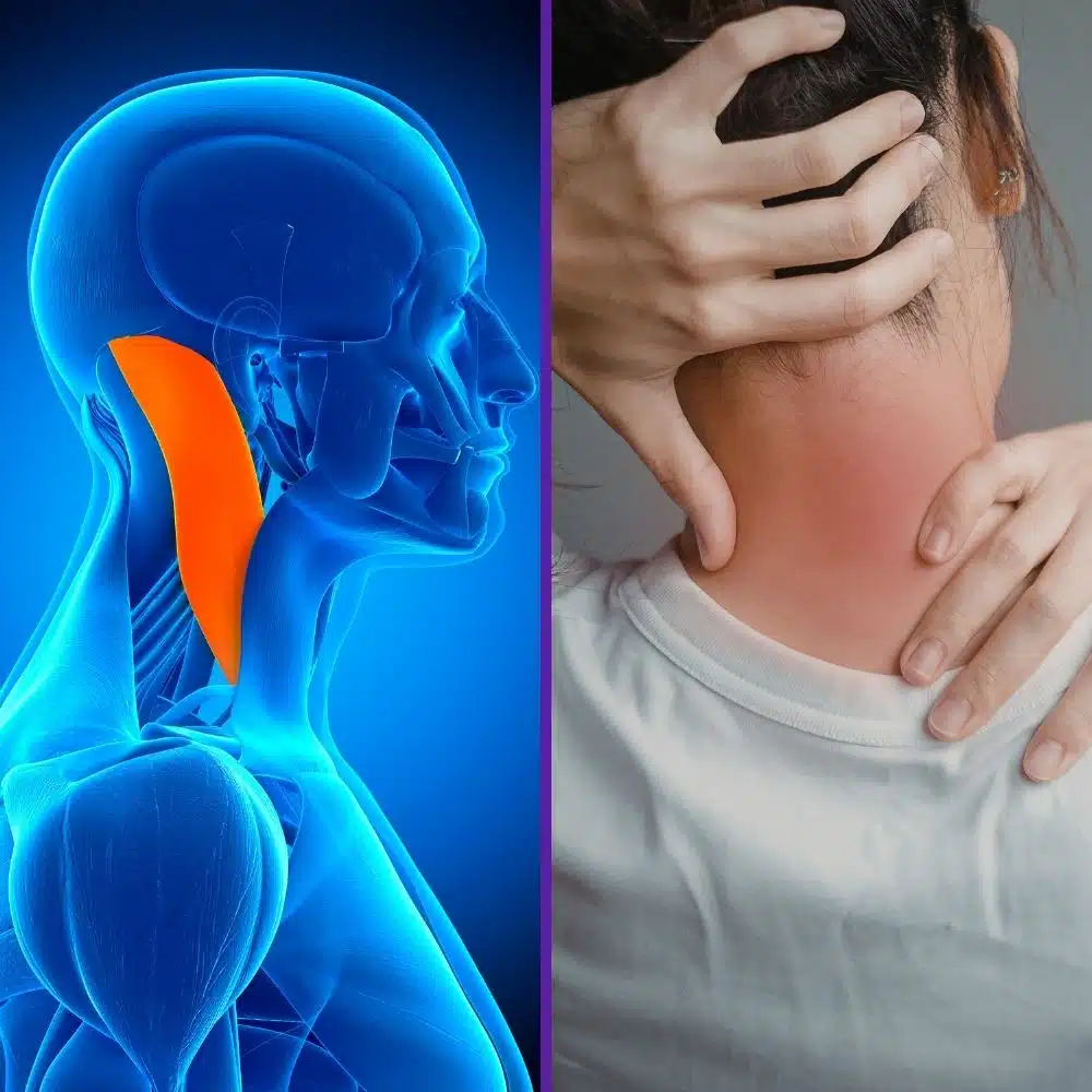 Head and Neck Cancers