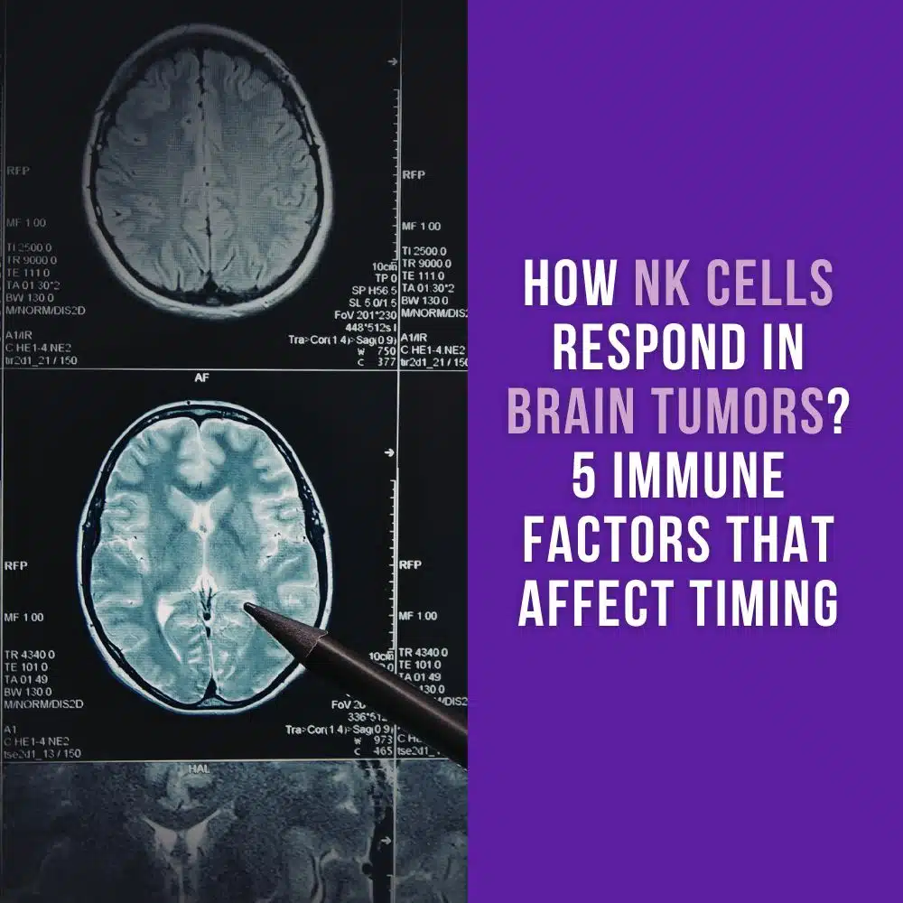 How NK Cells Respond in Brain Tumors? 5 Immune Factors That Affect Timing
