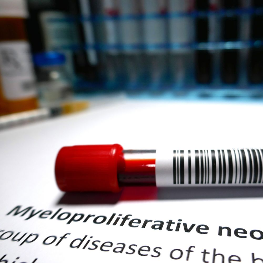 Myeloproliferative neoplasms