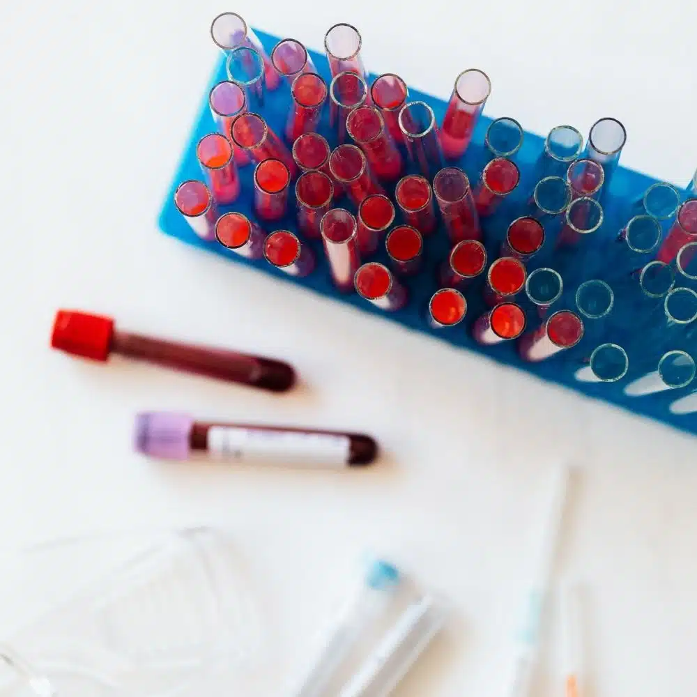 role of nk cells in hiv